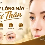 cấy lông mày