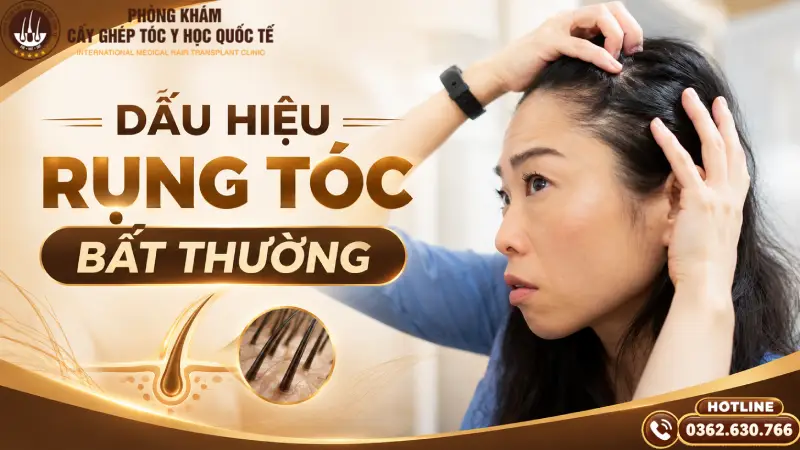 dấu hiệu rụng tóc bất thường