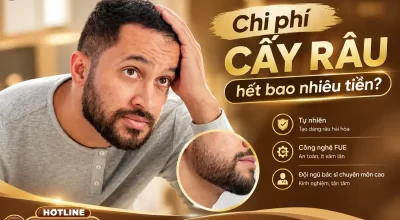 Chi phí cấy râu hết bao nhiêu tiền? Bảng Giá Chuẩn 2026