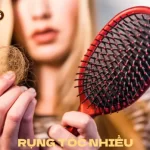 rụng tóc nhiều