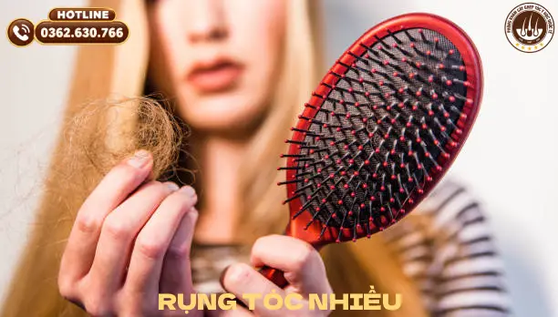 rụng tóc nhiều
